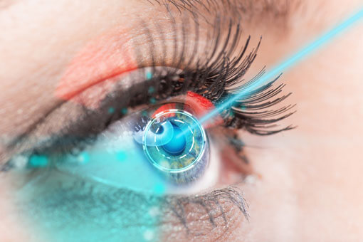 Laser performing cataract surgery